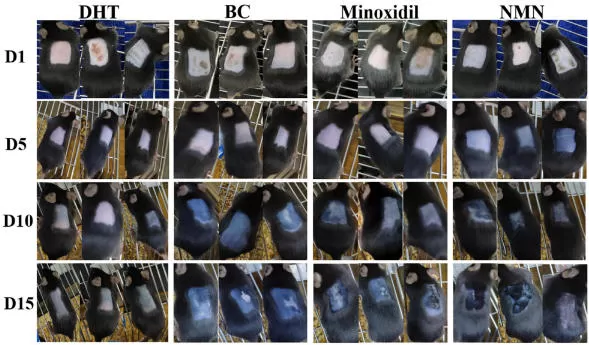 NMN and Hair Growth: New Evidence in Androgenetic Alopecia (AGA) NMN and Hair Growth: New Evidence in Androgenetic Alopecia (AGA)